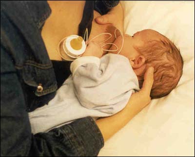 Breastfeeding using a lactation aid